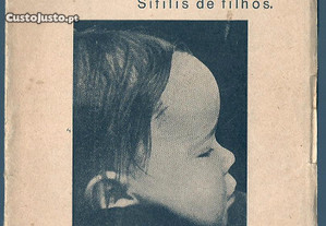 Dr, António de Carvalho - Sífilis de Pais... Sífilis de Filhos (1933)